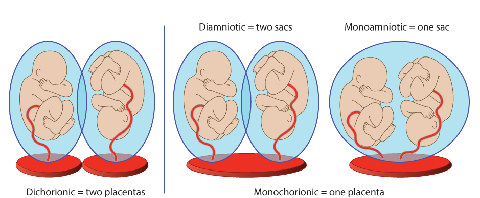 complex-pregnancy-content-image.png#asse